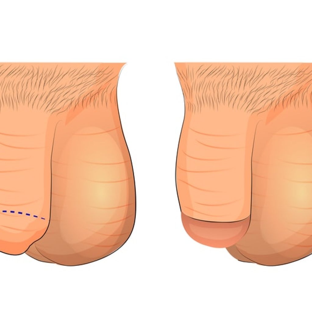 médico urólogo en Tijuana