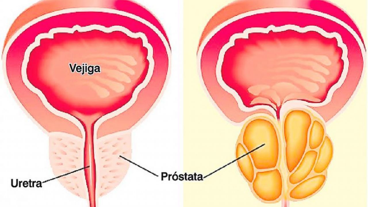 Conozcan algunas funciones la glándula prostática | Unidad Urología