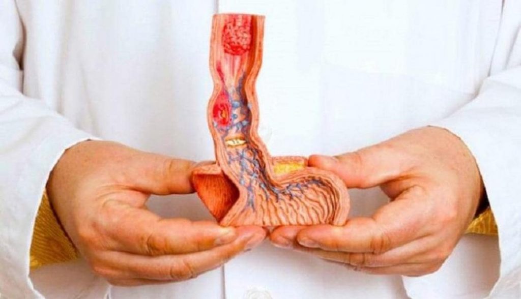 engrosamiento de pene