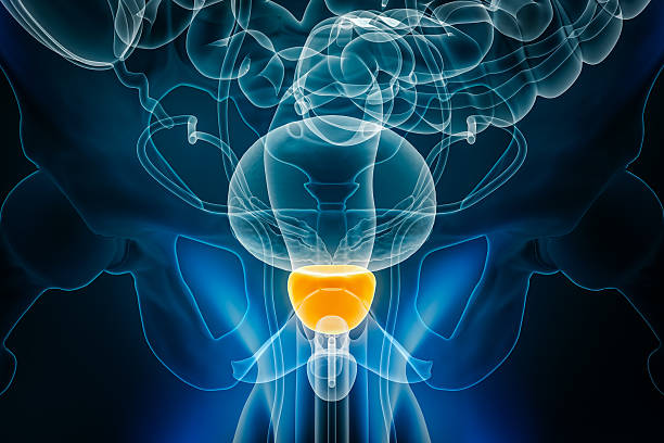tratamiento para el cáncer de próstata en Tijuana
