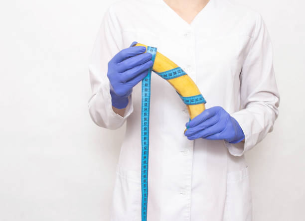¿Es permanente la cirugía de engrosamiento de pene? 2 médico con plátano en sus manos