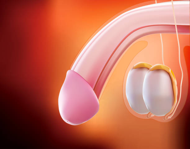 ¿Cómo se llama la cirugía para revertir la vasectomía y cómo se realiza? 2 vasectomía reversible